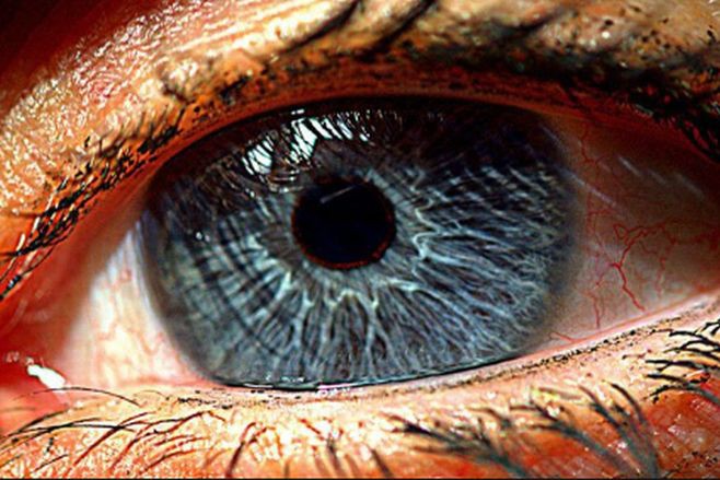 Ojo